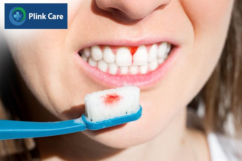 Triệu chứng của các bệnh về nướu răng