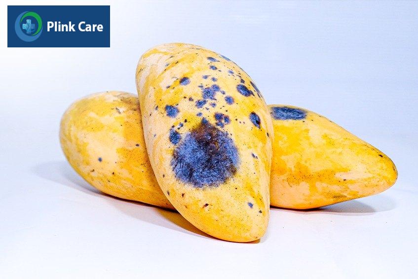 Giang mai giai đoạn 3 gây ra các tổn thương ăn sâu vào các cơ quan, nguy cơ gây tử vong