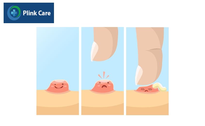 Thói quen chăm sóc da tốt là bước khởi đầu cho cả quá trình điều trị