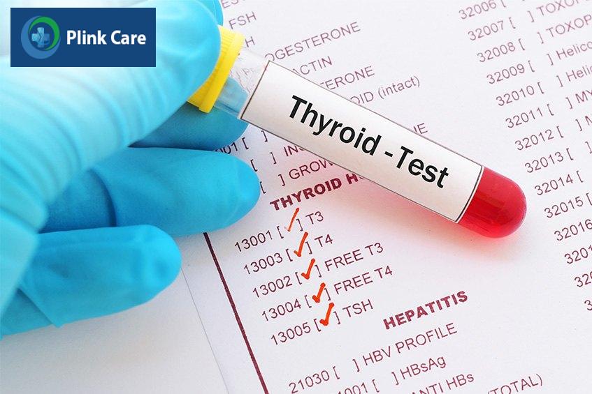 Chẩn đoán viêm tuyến giáp Hashimoto
