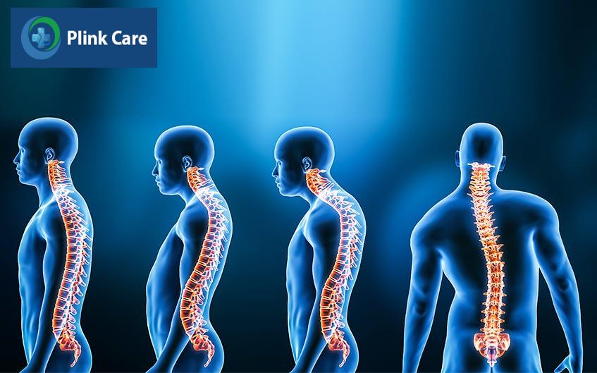 chỉ định can thiệp ngoại khoa đối với trường hợp nặng