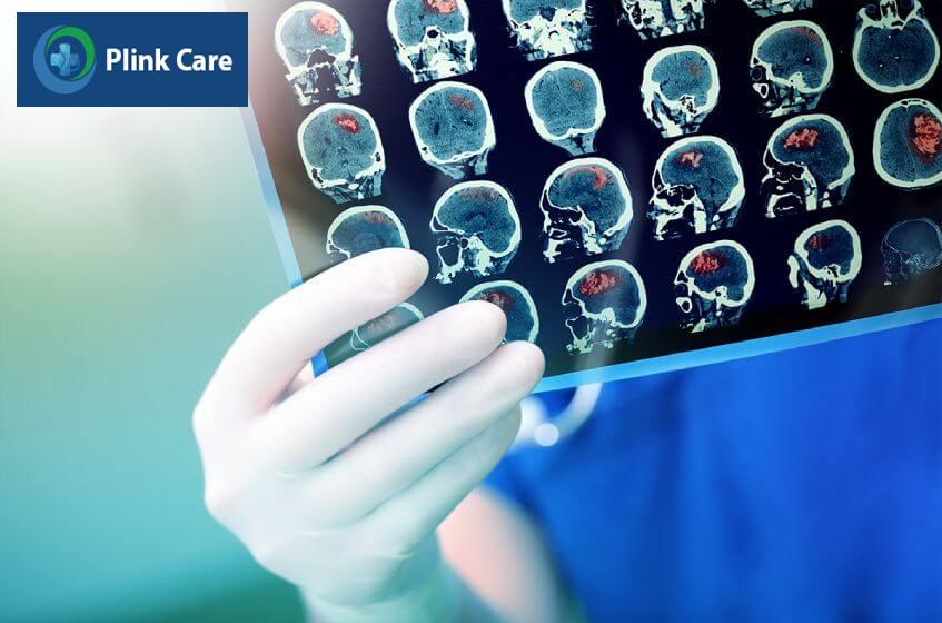chi phí để chụp mri