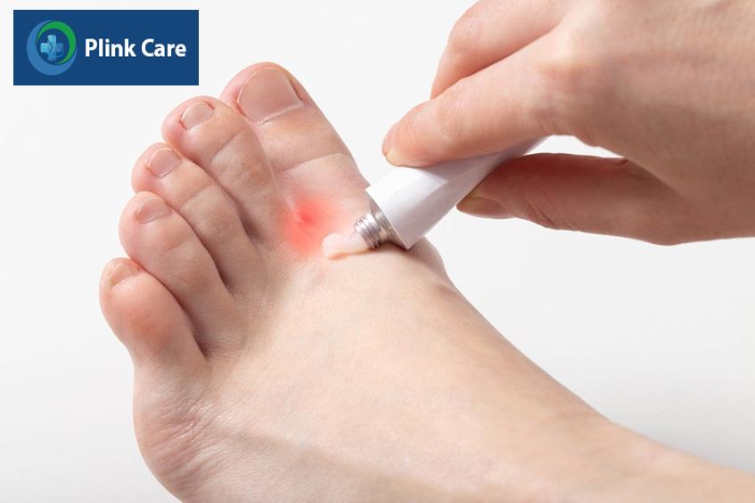 Corticosteroid có tác dụng kháng viêm