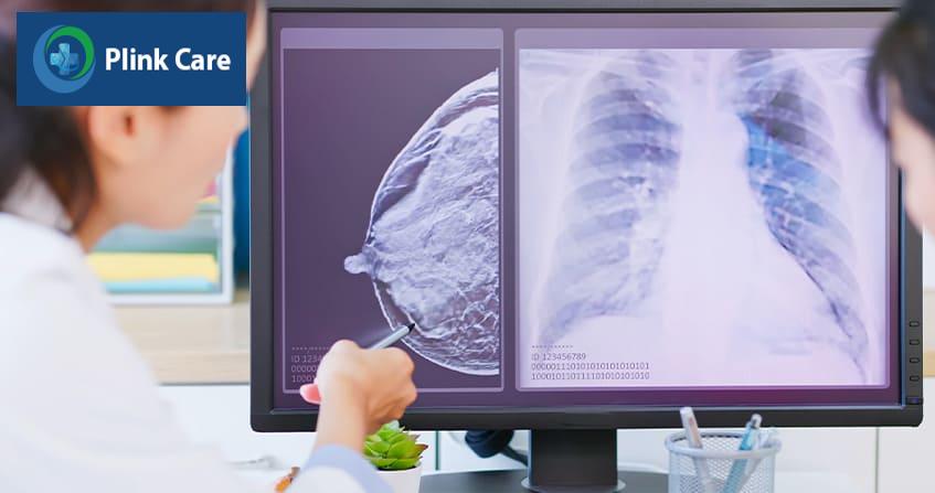 điều trị ung thư vú ở người trẻ tuổi