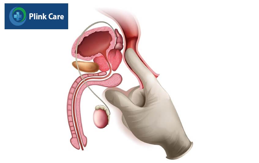 khám tầm soát bệnh ung thư hậu môn
