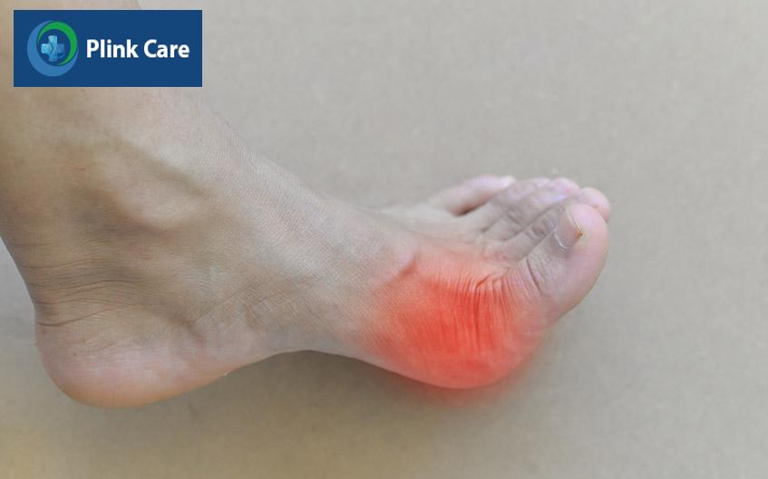 khớp ngón chân cái bị viêm
