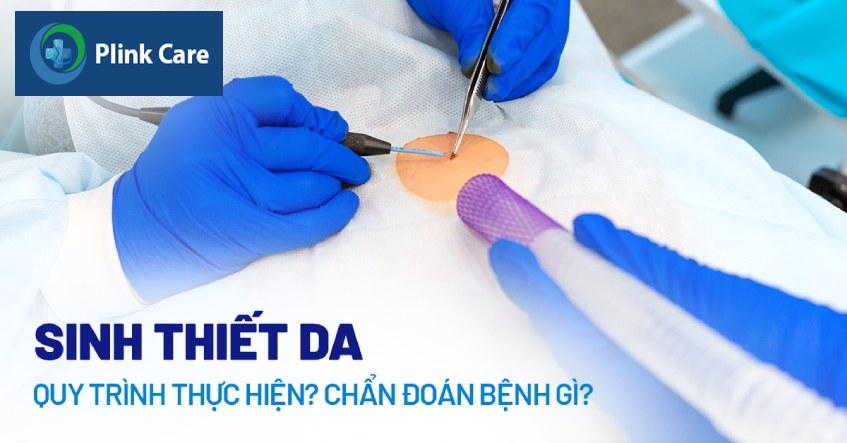 kỹ thuật sinh thiết da
