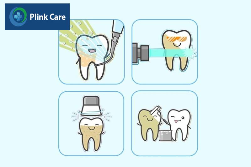 Quy trình lấy cao răng tại nha khoa
