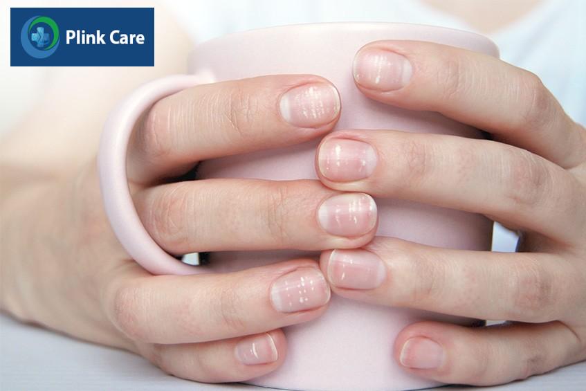 Móng tay giòn, dễ gãy có thể cảnh báo dấu hiệu tụt canxi