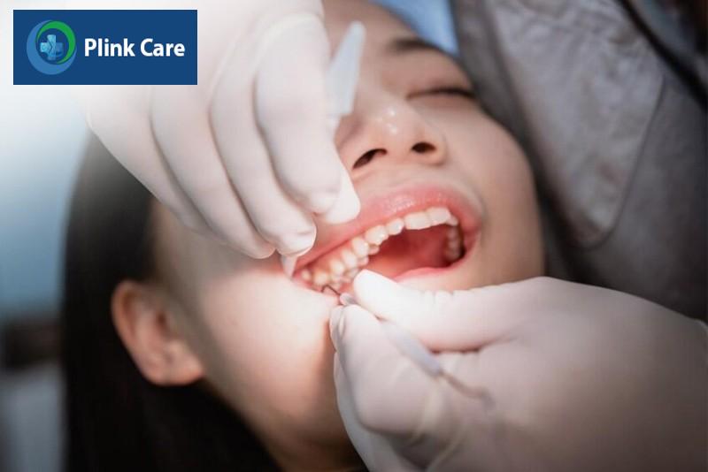 Nên nhổ răng vào lúc nào là tốt nhất?