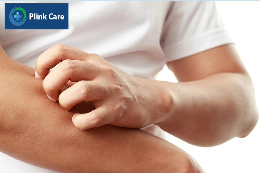 Ngứa bao quy đầu gây khó chịu cho nam giới