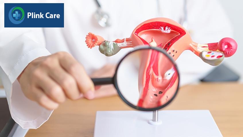 nguyên nhân khiến polyp tử cung tái phát