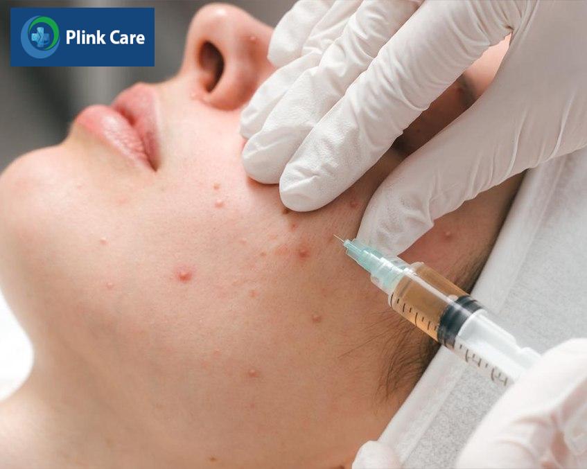 Đến bác sĩ da liễu để được điều trị mụn bọc an toàn, hiệu quả
