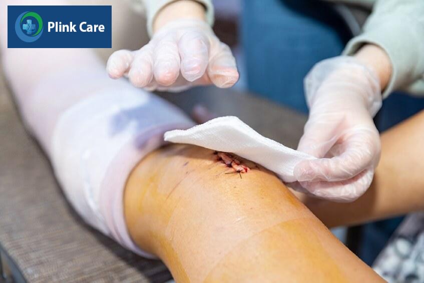 phòng ngừa nhiễm trùng vết mổ