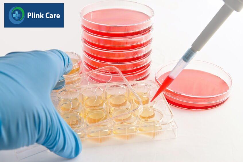 phương pháp điều trị bại não bằng tế bào gốc