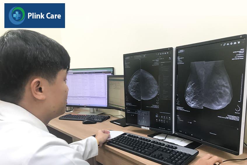 sàng lọc ung thư vú ở người trẻ