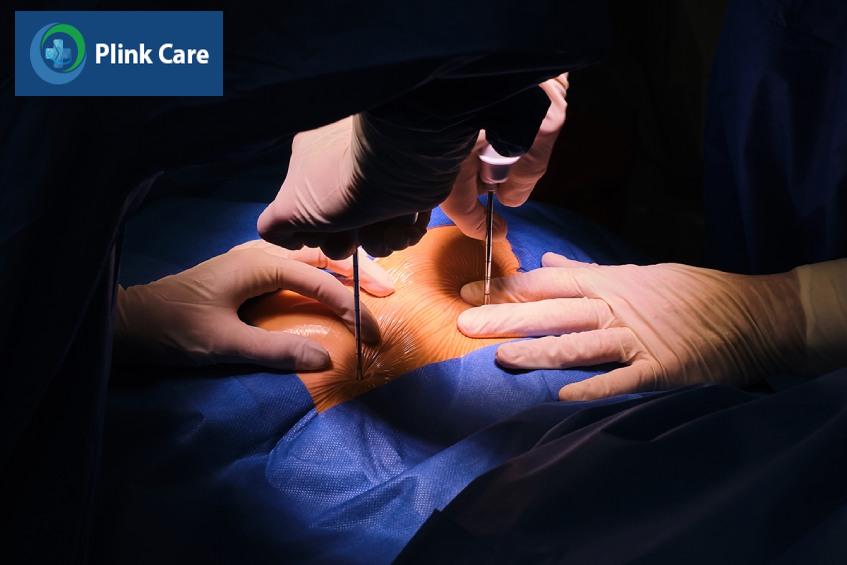 sinh thiết tủy xương có đau không