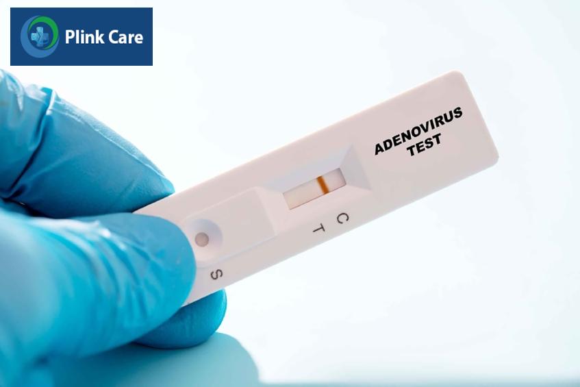 Test nhanh adenovirus