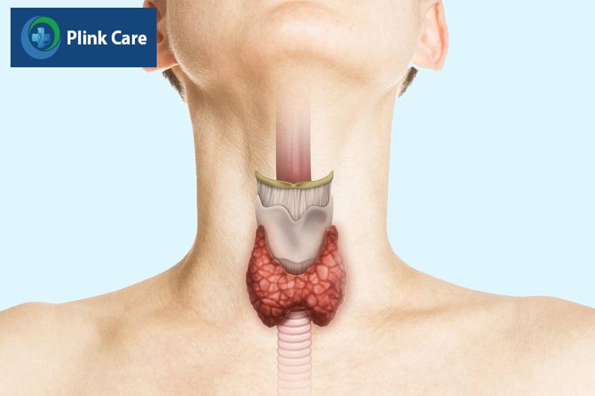 Viêm tuyến giáp bán cấp hiếm gặp, thường do virus gây ra