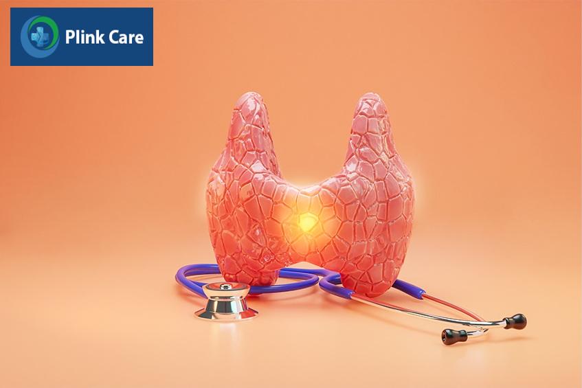 Viêm tuyến giáp bán cấp là bệnh xảy ra cấp tính
