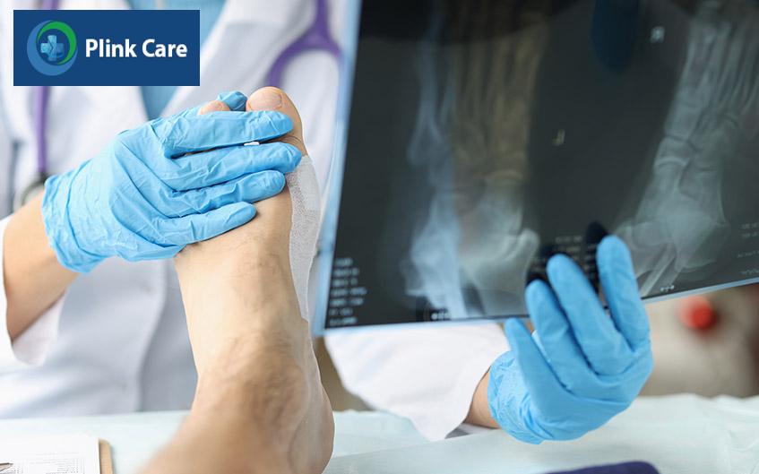 x quang giúp phát hiện tình trạng viêm của khớp