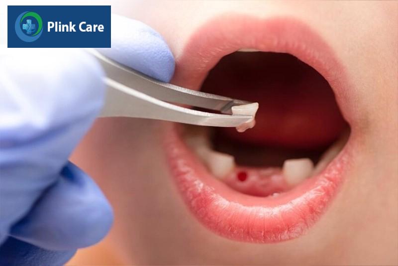 Nhổ răng sữa có đau không?