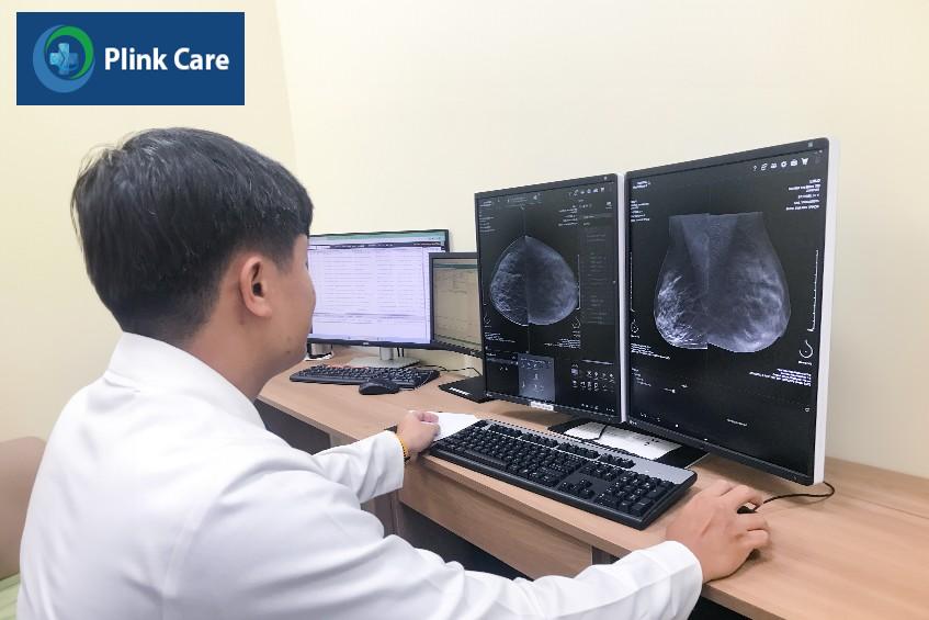 cảm giác khối u vú thế nào