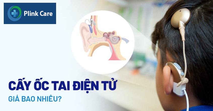 cấy ốc tai điện tử