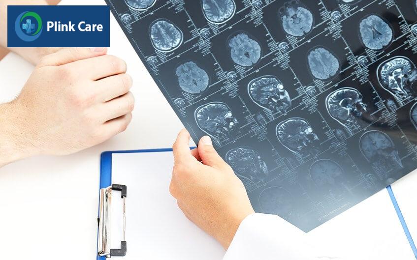 chẩn đoán chứng đau đầu từng cơn