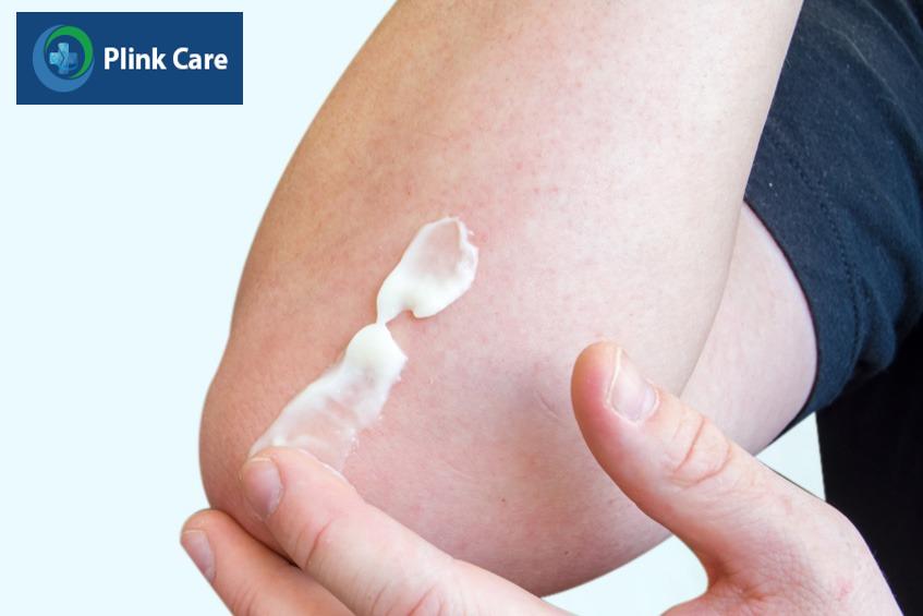 Điều trị bệnh ngoài da với thuốc bôi corticoid