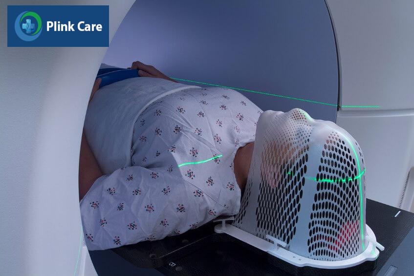 điều trị u thần kinh đệm bậc cao