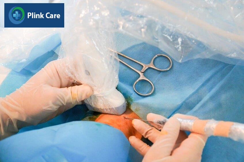 điều trị u tuyến giáp bằng đốt sóng cao tần