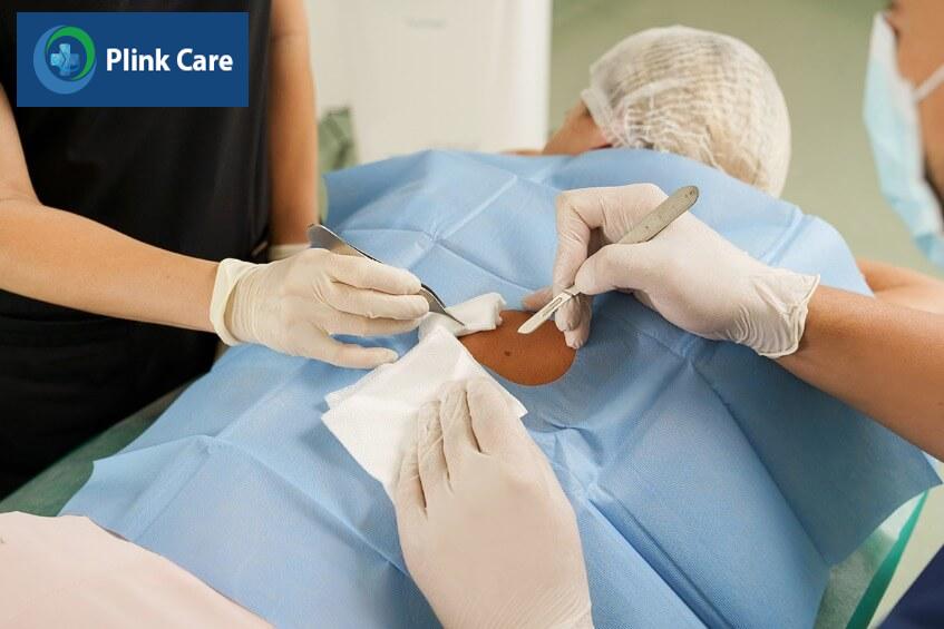 điều trị ung thư da giai đoạn đầu