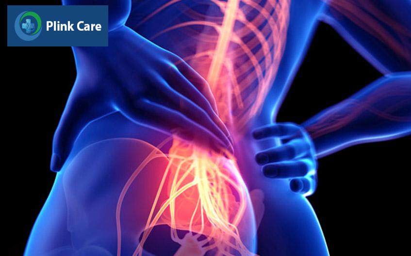 gây ra biến chứng chùm đuôi ngựa