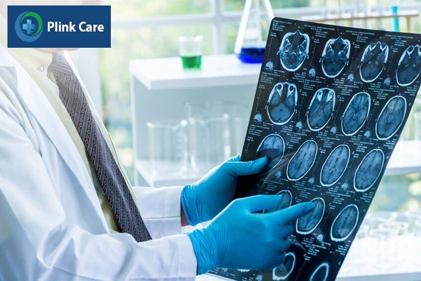 hình ảnh chẩn đoán u thần kinh đệm cầu não lan tỏa