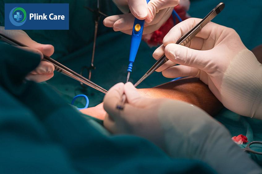 Kỹ thuật cần được thực hiện bởi bác sĩ chuyên môn cao với sự hỗ trợ của hệ thống trang thiết bị hiện đại