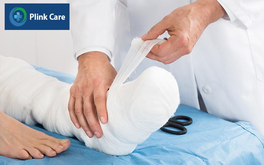 nẹp bột để cố định chân