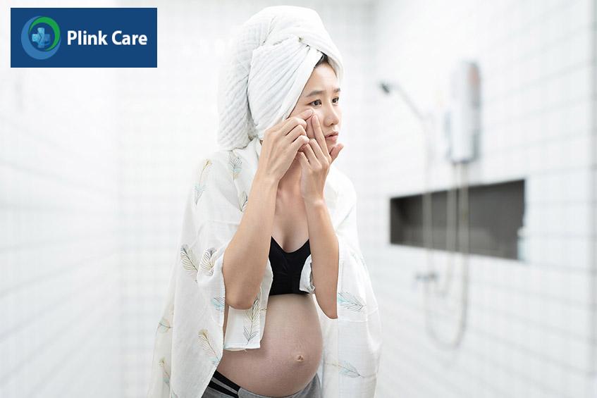 nổi mụn trứng cá là dấu hiệu mang thai bé trai