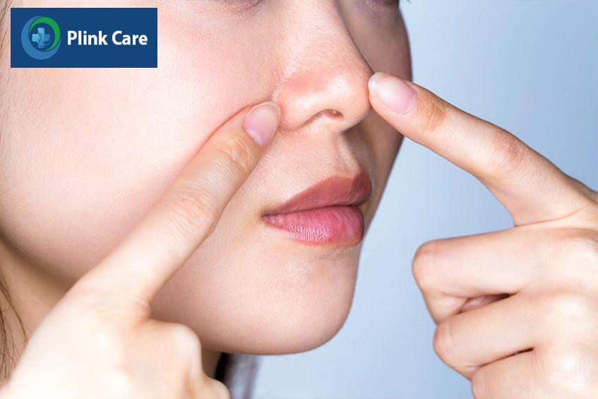 biện pháp phòng ngừa mụn cám ở mũi