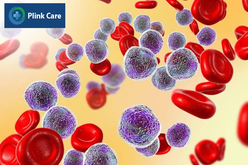 ung thư máu và điều trị bằng tế bào gốc