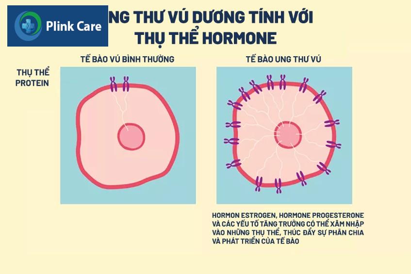 Ung thư vú có thụ thể nội tiết dương tính