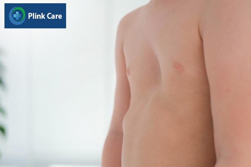 Vết lõm vào ngay giữa ngực có thể gây chèn ép tim, phổi