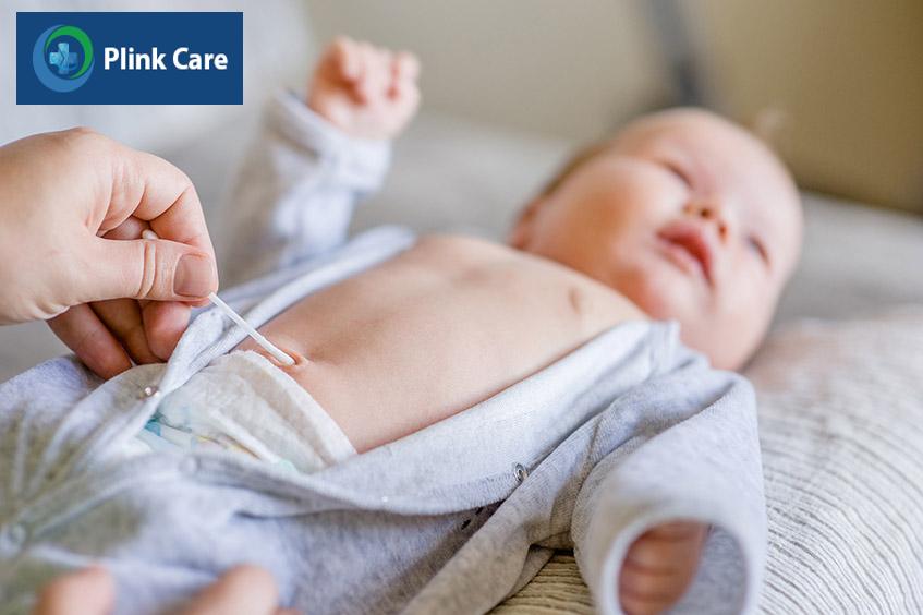 Bố mẹ nên sử dụng que bông hoặc bông đã được vô trùng vô khuẩn, tẩm cồn 70 độ để vệ sinh rốn hàng ngày cho trẻ