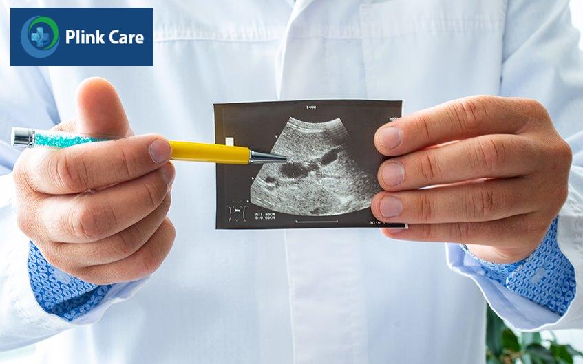 chẩn đoán túi mật sứ