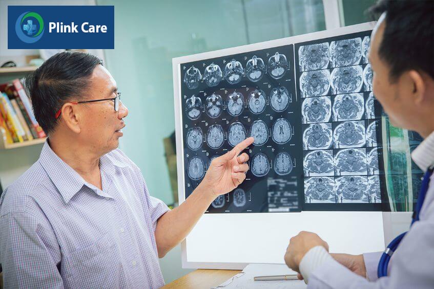 chẩn đoán u tế bào thần kinh đệm ít nhánh