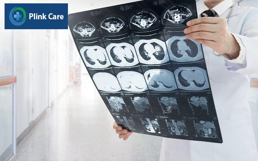 chụp ct u gan chẩn đoán ung thư gan