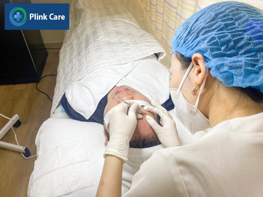 điều trị mụn cám tại PlinkCare