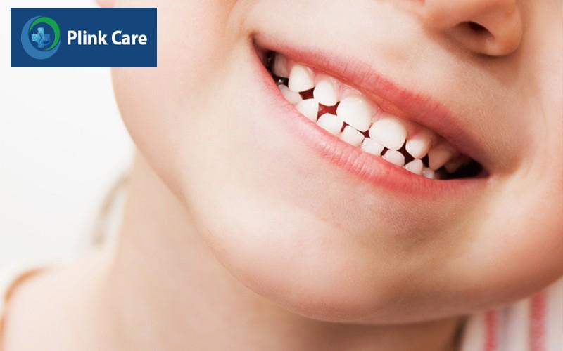 Thay răng sữa ở trẻ em khi nào cần đến nha sĩ?