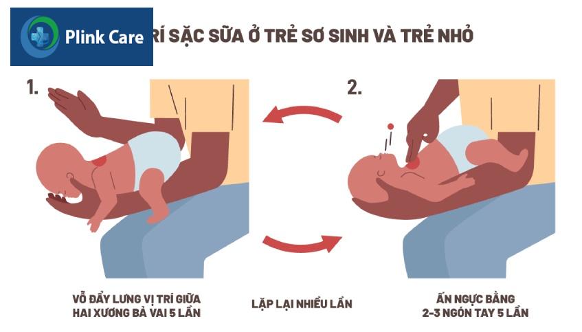 Hướng dẫn mẹ cách sơ cứu khi bé bị sặc sữa