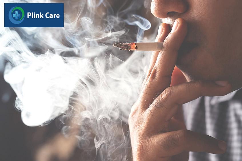 Hút thuốc lá là yếu tố nguy cơ chính của chứng phình động mạch chủ bụng